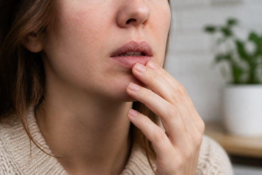 How to Prevent Dry Chapped Lips: 2026 Guide